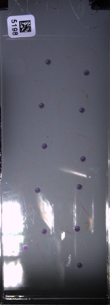 Media type: image; Special Collections 4011   shows specimen_part histological serial section;